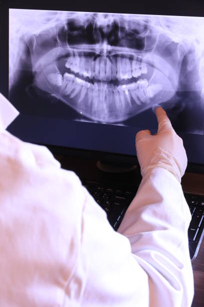 Best Emergency Wisdom Teeth Removal in Lagrange, OH