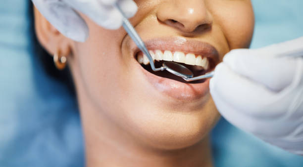 Best Emergency Wisdom Teeth Removal in Lagrange, OH