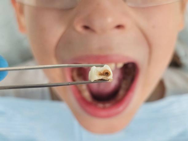 Best Pediatric Emergency Dentist in Lagrange, OH