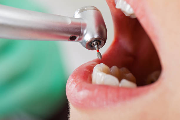 Best Emergency Treatment for Toothache in Lagrange, OH